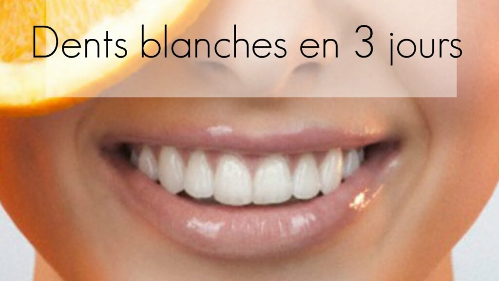 Comment avoir des dents blanches en 2 jours ?