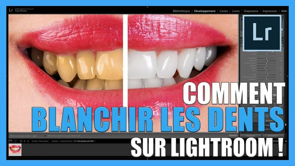 Comment blanchir les dents dans Lightroom ?